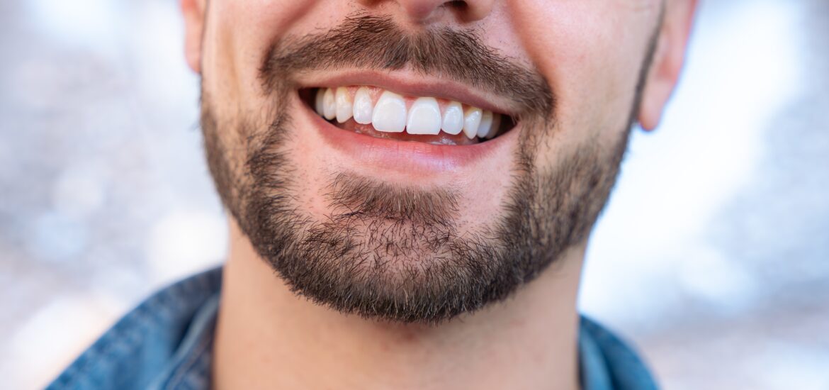 Close-up portrait of a smiling young man showing his perfect white teeth.