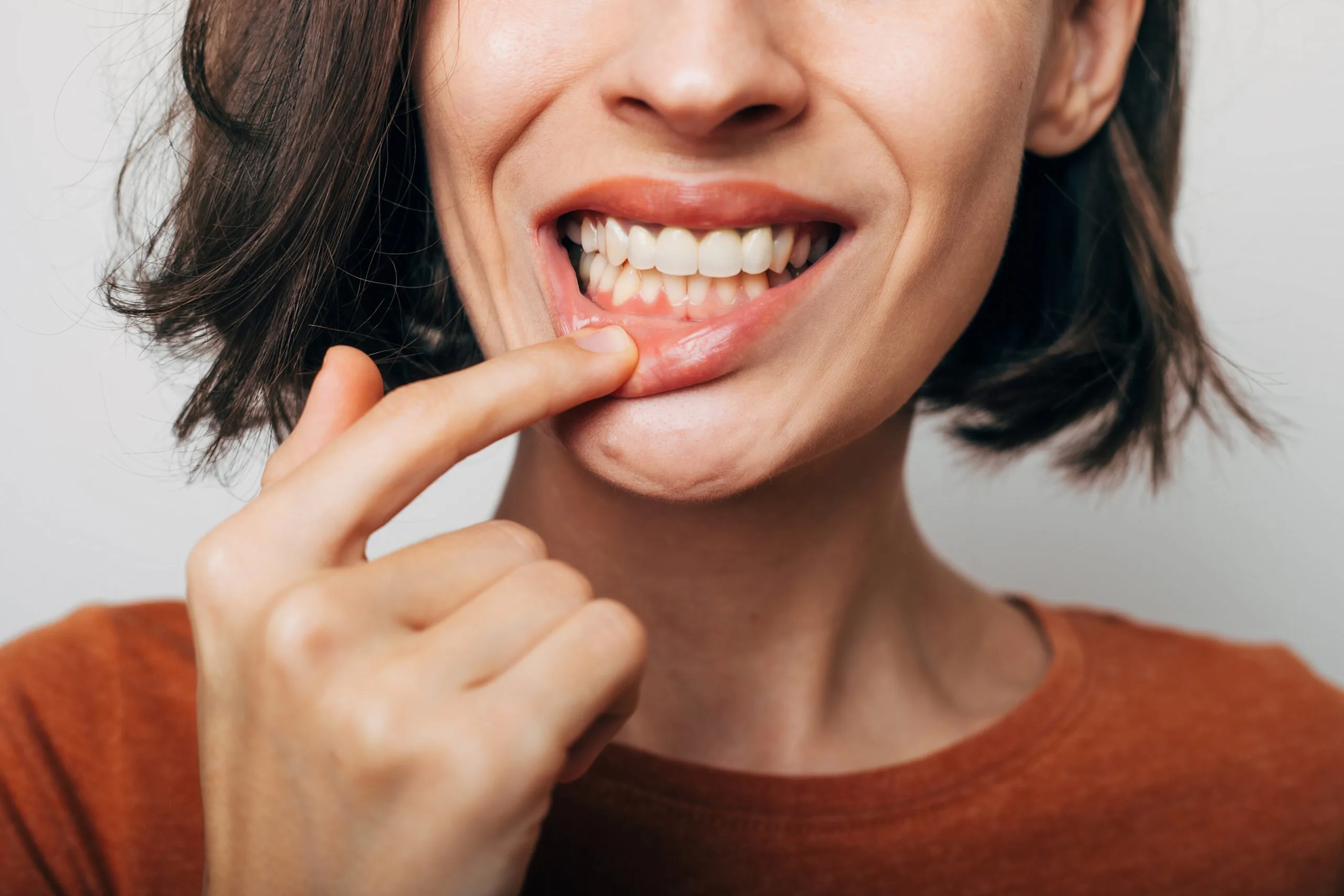 closeup shot of a woman's slightly inflamed gum line