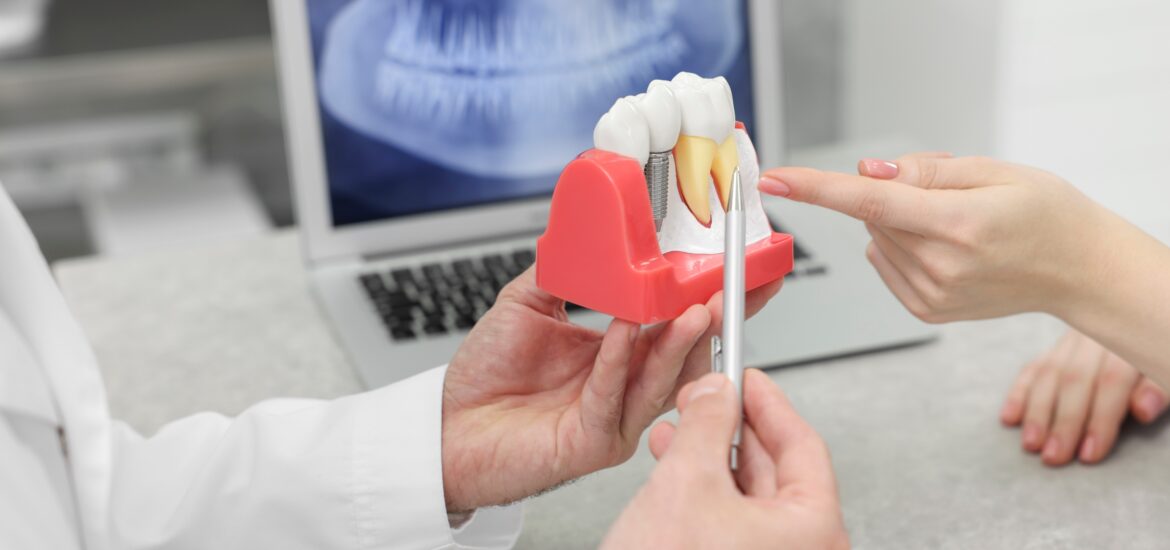 dentist showing a patient an implant model