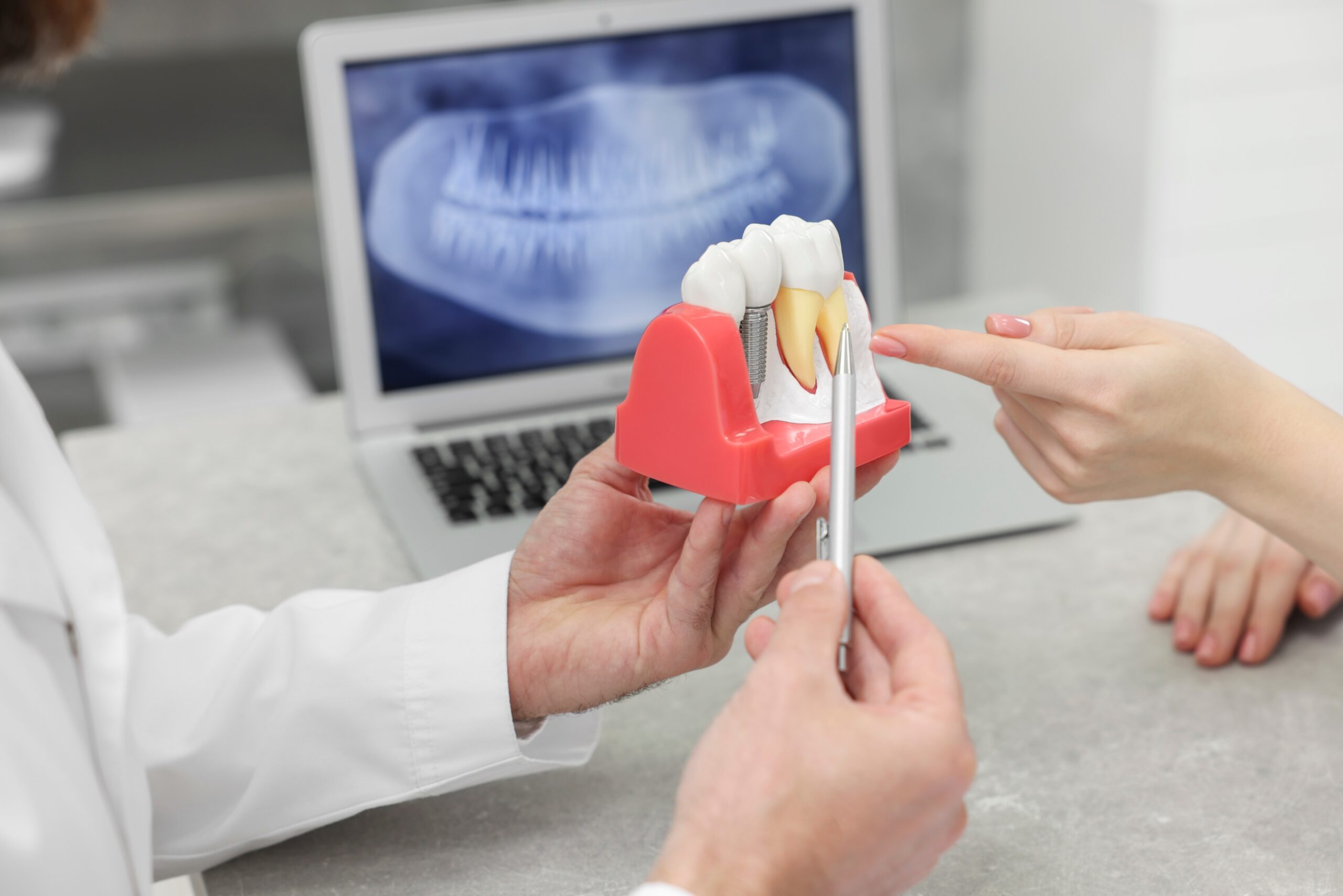 dentist showing a patient an implant model