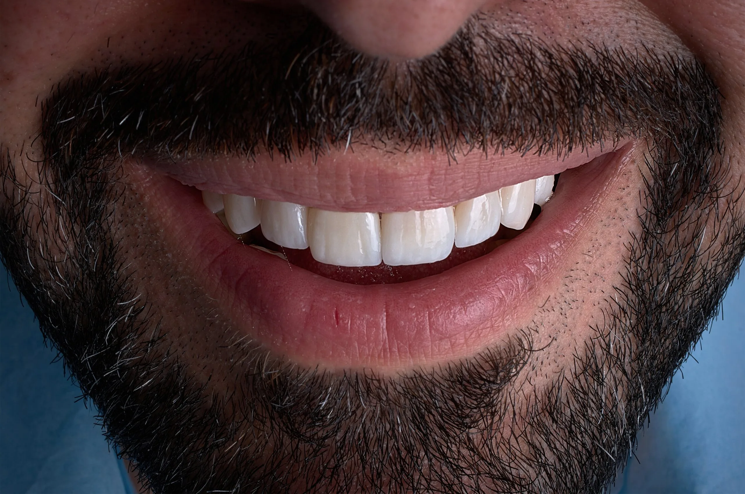 dental bonding improves the appearance of teeth, gums,